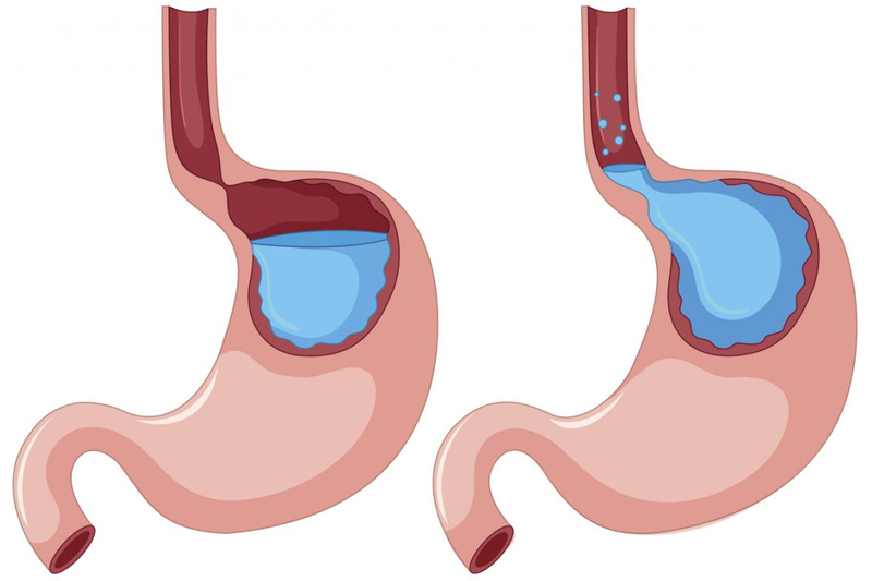 Endoscopic Retrograde Cholangio-Pancreatography (ERCP) test in Gurgaon & Dehli NCR